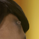 Image for article titled Dr. Pimple Popper Goes Head-to-Head With a Nipple... on Someone's Head